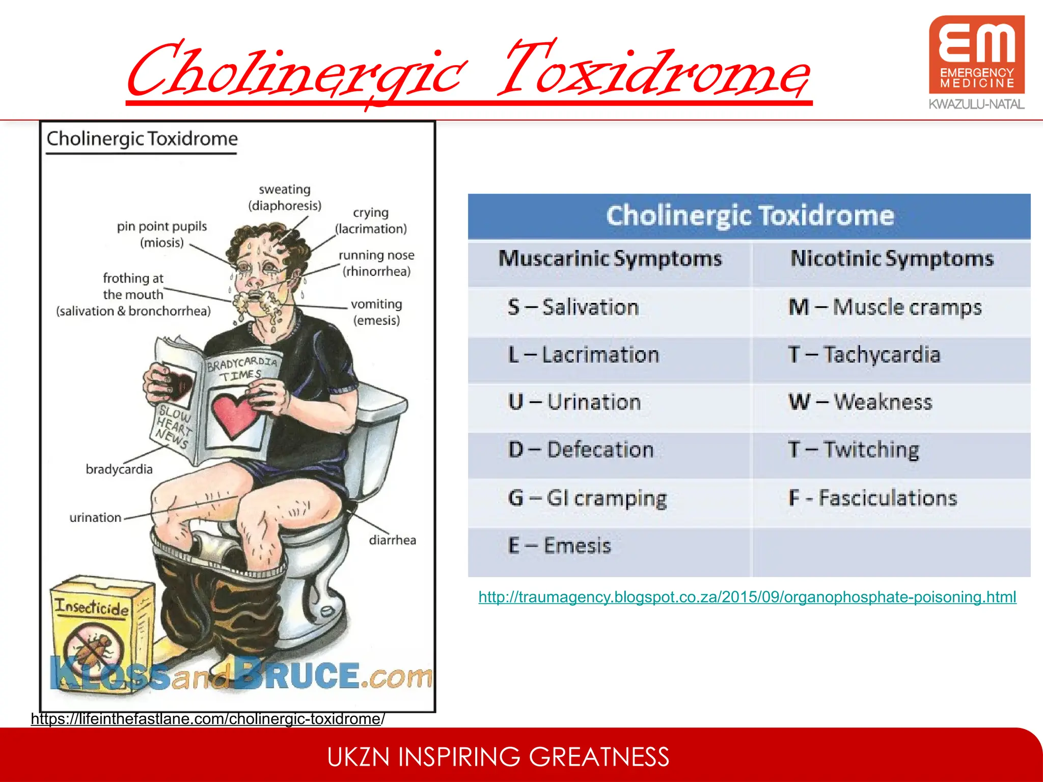 UKZN INSPIRING GREATNESS
Cholinergic Toxidrome
https://lifeinthefastlane.com/cholinergic-toxidrome/
http://traumagency.blogspot.co.za/2015/09/organophosphate-poisoning.html
 