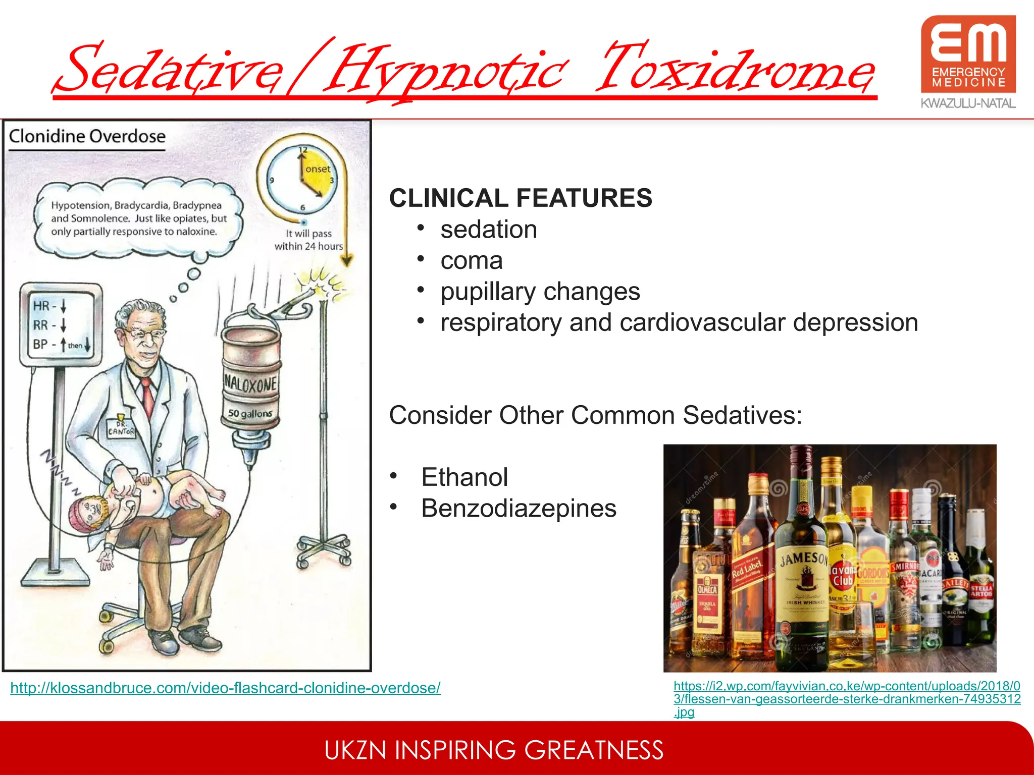 UKZN INSPIRING GREATNESS
Sedative/Hypnotic Toxidrome
http://klossandbruce.com/video-flashcard-clonidine-overdose/
CLINICAL FEATURES
• sedation
• coma
• pupillary changes
• respiratory and cardiovascular depression
Consider Other Common Sedatives:
• Ethanol
• Benzodiazepines
https://i2.wp.com/fayvivian.co.ke/wp-content/uploads/2018/0
3/flessen-van-geassorteerde-sterke-drankmerken-74935312
.jpg
 