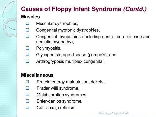 An approach to a Floppy infant Dr Sujit