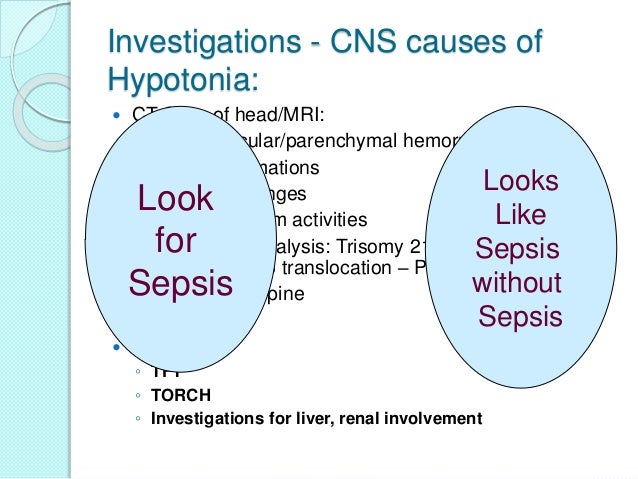 An approach to a Floppy infant Dr Sujit