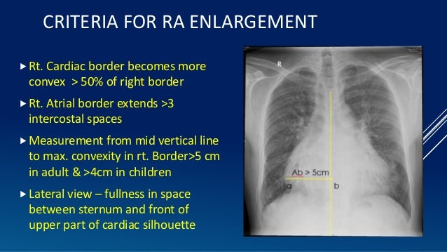 An Approach To Cardiac Xray Dr Muhammad Bin Zulfiqar