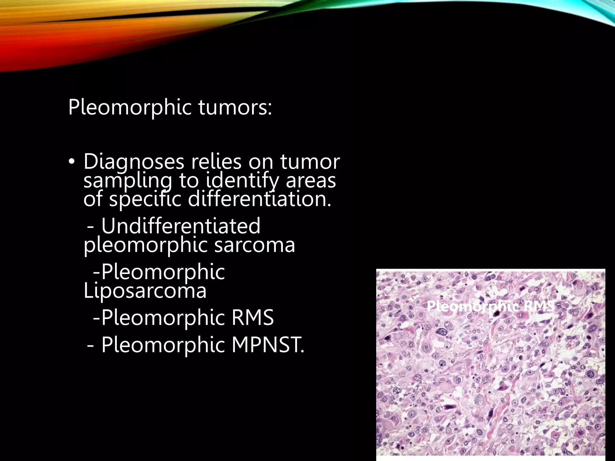 Pleomorphic Rms An approach to diagonosis of soft tissue sarcoma.pptx