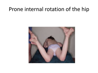 Prone internal rotation of the hip
 