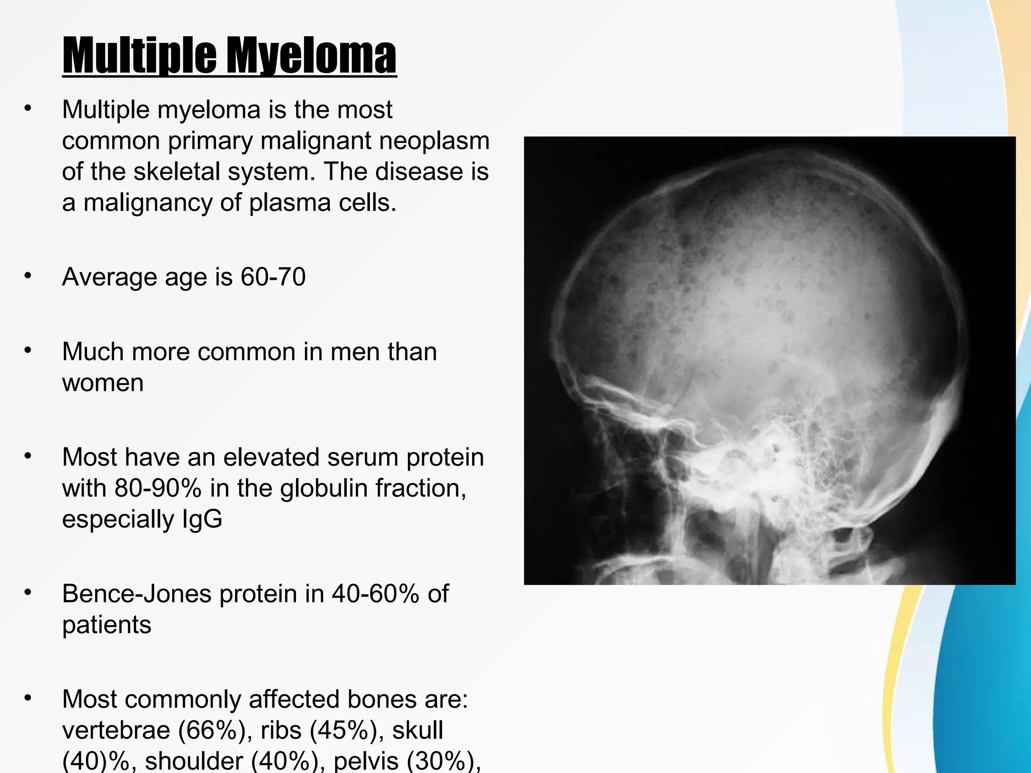 An approach to malignant bone tumors | PPT