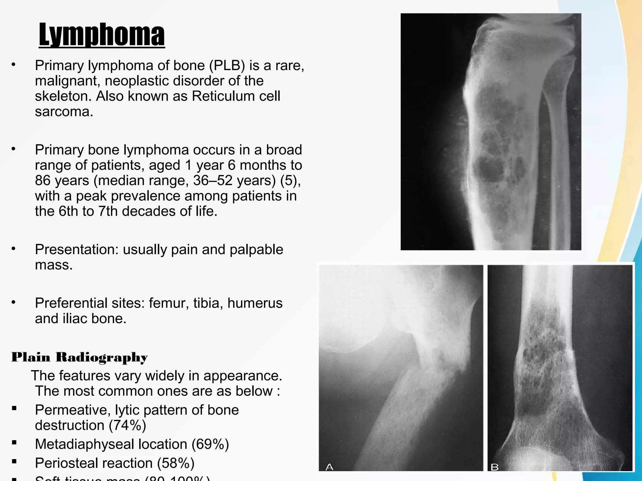 An approach to malignant bone tumors | PPT
