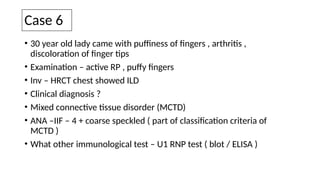 Case 6
• 30 year old lady came with puffiness of fingers , arthritis ,
discoloration of finger tips
• Examination – active RP , puffy fingers
• Inv – HRCT chest showed ILD
• Clinical diagnosis ?
• Mixed connective tissue disorder (MCTD)
• ANA –IIF – 4 + coarse speckled ( part of classification criteria of
MCTD )
• What other immunological test – U1 RNP test ( blot / ELISA )
 