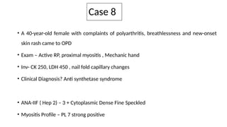 Case 8
• A 40-year-old female with complaints of polyarthritis, breathlessness and new-onset
skin rash came to OPD
• Exam – Active RP, proximal myositis , Mechanic hand
• Inv- CK 250, LDH 450 , nail fold capillary changes
• Clinical Diagnosis? Anti synthetase syndrome
• ANA-IIF ( Hep 2) – 3 + Cytoplasmic Dense Fine Speckled
• Myositis Profile – PL 7 strong positive
 