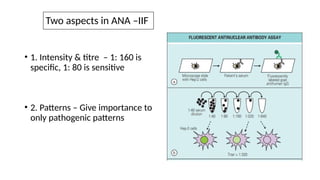 Two aspects in ANA –IIF
• 1. Intensity & titre – 1: 160 is
specific, 1: 80 is sensitive
• 2. Patterns – Give importance to
only pathogenic patterns
 
