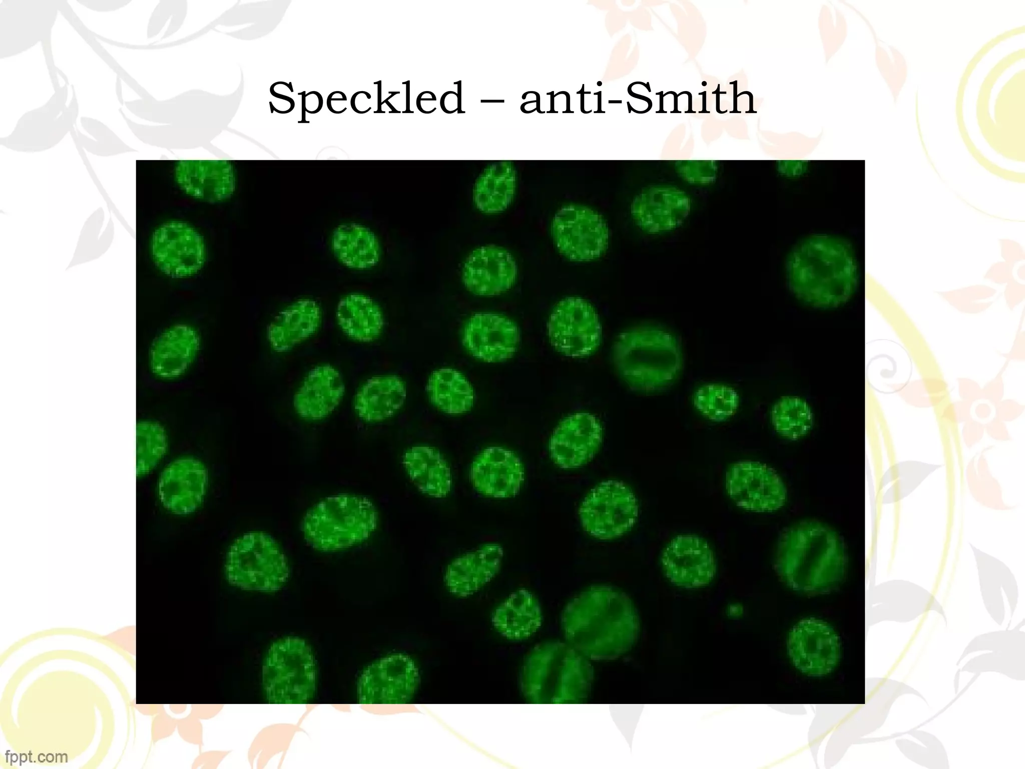 Speckled – anti-Smith
 