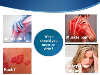 Joint pain ?
Rash?
Muscle pain?
 Unexplained
fatigue?
 