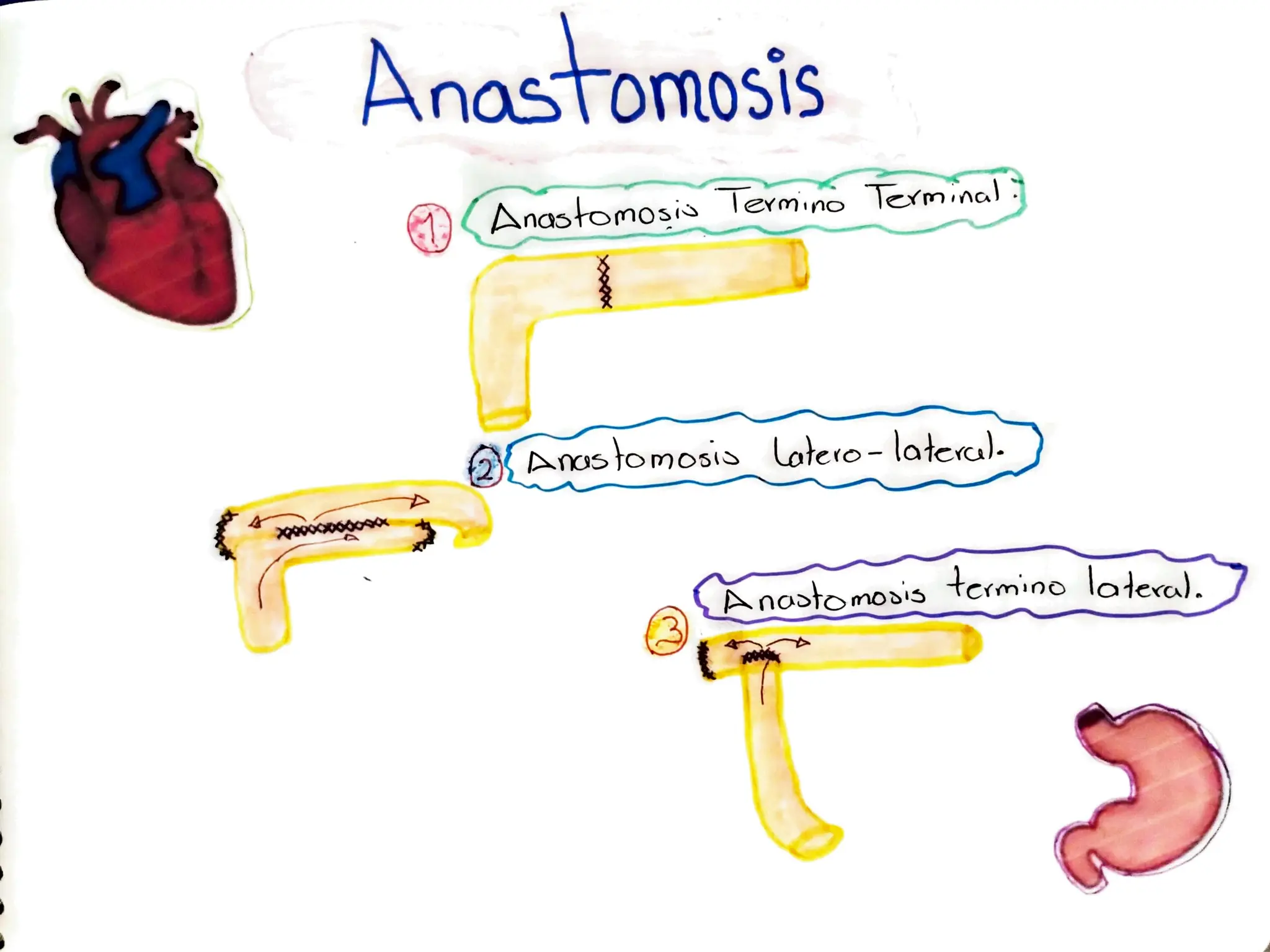 Anastomosis Intestinal termino-terminal, latero-lateral y termino ...