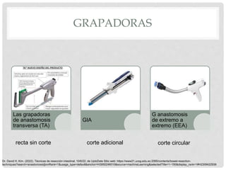 GRAPADORAS
Las grapadoras
de anastomosis
transversa (TA)
GIA
G anastomosis
de extremo a
extremo (EEA)
recta sin corte corte adicional corte circular
Dr. David H. Kim. (2022). Técnicas de resección intestinal. 10/6/22, de UptoDate Sitio web: https://www21.ucsg.edu.ec:2065/contents/bowel-resection-
techniques?search=anastomosis§ionRank=1&usage_type=default&anchor=H3950246010&source=machineLearning&selectedTitle=1~150&display_rank=1#H2309422938
 
