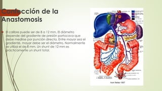 Confección de la
Anastomosis
 El calibre puede ser de 8 a 12 mm. El diámetro
depende del gradiente de presión portocava que
debe medirse por punción directa. Entre mayor sea el
gradiente, mayor debe ser el diámetro. Normalmente
se utiliza el de 8 mm. Un shunt de 12 mm es
prácticamente un shunt total.
 