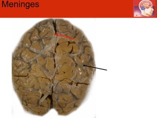 Meninges  