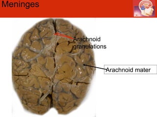 Meninges  Arachnoid granulations Arachnoid mater 