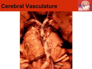 Cerebral Vasculature 
