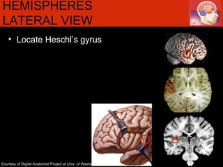 HEMISPHERES LATERAL VIEW  Locate Heschl’s gyrus Courtesy of Digital Anatomist Project at Univ. of Washington 