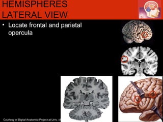 HEMISPHERES LATERAL VIEW  Locate frontal and parietal opercula Courtesy of Digital Anatomist Project at Univ. of Washington 