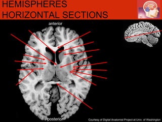 anterior posterior HEMISPHERES HORIZONTAL SECTIONS Courtesy of Digital Anatomist Project at Univ. of Washington 