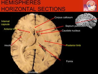 anterior posterior Internal capsule HEMISPHERES HORIZONTAL SECTIONS Fornix Posterior limb insula Anterior limb Septum pellucidum Caudate nucleus Corpus callosum 