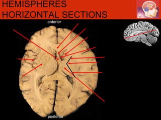 anterior posterior HEMISPHERES HORIZONTAL SECTIONS 