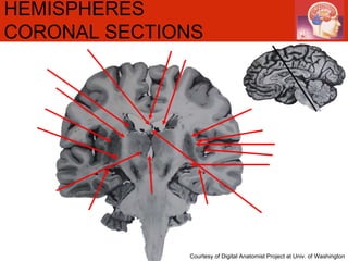 HEMISPHERES CORONAL SECTIONS   Courtesy of Digital Anatomist Project at Univ. of Washington 
