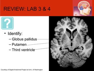 REVIEW: LAB 3 & 4 Identify: Globus pallidus Putamen Third ventricle  Courtesy of Digital Anatomist Project at Univ. of Washington 