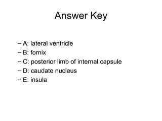 Answer Key A: lateral ventricle B: fornix C: posterior limb of internal capsule D: caudate nucleus E: insula 