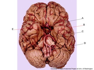 A B C D E Courtesy of Digital Anatomist Project at Univ. of Washington 