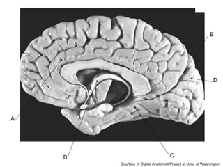 A B C D E Courtesy of Digital Anatomist Project at Univ. of Washington 