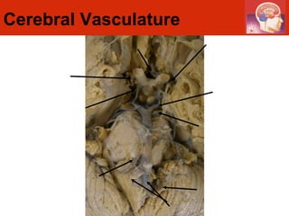 Cerebral Vasculature 