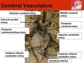 Cerebral Vasculature Posterior communicating artery Superior cerebellar artery Anterior inferior cerebellar artery Internal carotid artery Vertebral arteries Posterior inferior cerebellar artery Middle cerebral artery Anterior cerebral artery Posterior cerebral artery 
