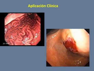 Aplicación Clínica

 