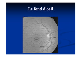 Le fond d’oeil
        d’oeil
 