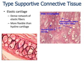 Type Supportive Connective TissueElastic cartilageDense network of elastic fibersMore flexible than hyaline cartilage