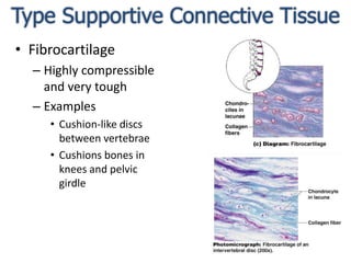 Type Supportive Connective TissueFibrocartilageHighly compressible and very toughExamplesCushion-like discs between vertebraeCushions bones in knees and pelvic girdle
