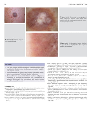 An Atlas of Dermoscopy, Second Edition ( PDFDrive ).pdf