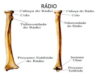 RÁDIO
 