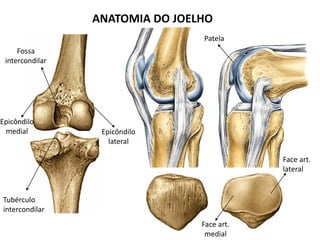 ANATOMIA DO JOELHO
Patela
Fossa
intercondilar
Epicôndilo
lateral
Epicôndilo
medial
Tubérculo
intercondilar
Face art.
lateral
Face art.
medial
 