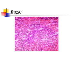 Bazo: 