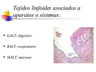 T ejidos linfoides asociados a aparatos o sistemas : GALT : digestivo BALT :  respiratorio MALT:   mucosas 