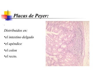 .  D istribuidos  en:   el intestino delgado el apéndice  el colon  el recto.   Placas de Peyer: 
