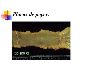 Placas de peyer: 