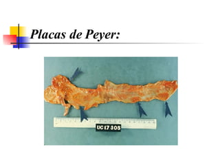 Placas de Peyer: 