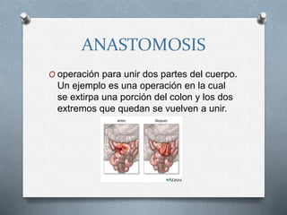 ANASTOMOSIS
O operación para unir dos partes del cuerpo.
Un ejemplo es una operación en la cual
se extirpa una porción del colon y los dos
extremos que quedan se vuelven a unir.
 