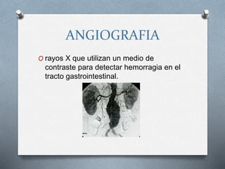 ANGIOGRAFIA
O rayos X que utilizan un medio de
contraste para detectar hemorragia en el
tracto gastrointestinal.
 