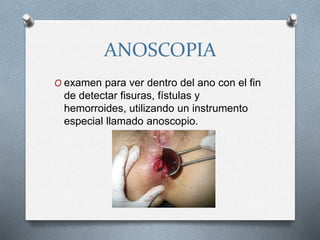 ANOSCOPIA
O examen para ver dentro del ano con el fin
de detectar fisuras, fístulas y
hemorroides, utilizando un instrumento
especial llamado anoscopio.
 