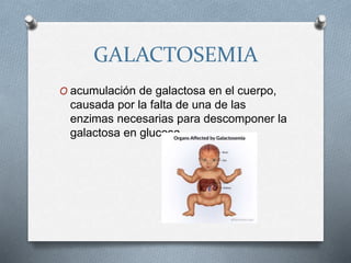 GALACTOSEMIA
O acumulación de galactosa en el cuerpo,
causada por la falta de una de las
enzimas necesarias para descomponer la
galactosa en glucosa.
 