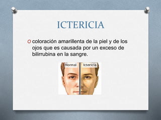 ICTERICIA
O coloración amarillenta de la piel y de los
ojos que es causada por un exceso de
bilirrubina en la sangre.
 
