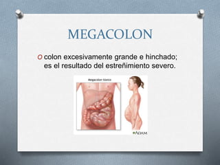 MEGACOLON
O colon excesivamente grande e hinchado;
es el resultado del estreñimiento severo.
 